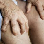 Osteoarthritis