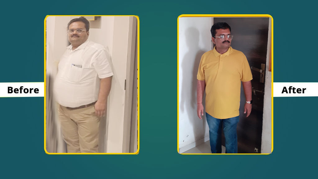 GHS - Weight Loss - Before and After Alpesh