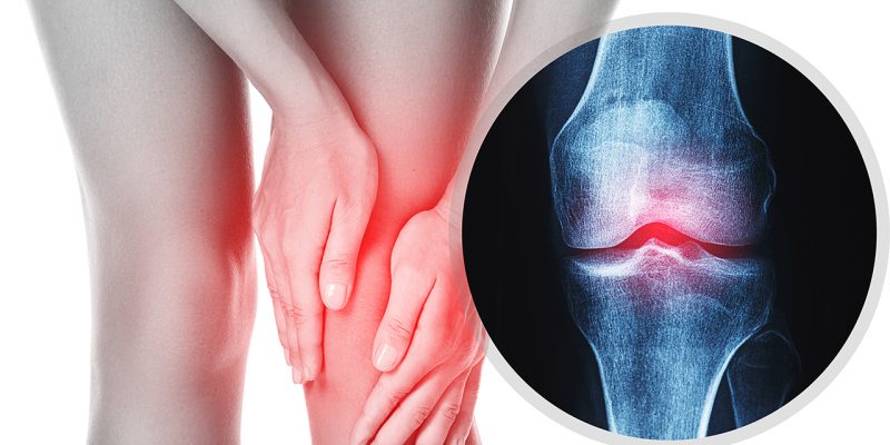 Menopause and Bone Health: How to Prevent Osteoporosis Before It’s Too Late